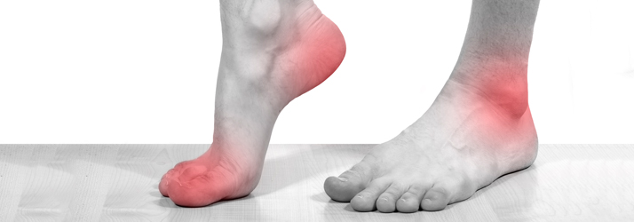 Chiropractic Delray Beach FL Neuropathy Chiropractic Delray Beach FL Neuropathy