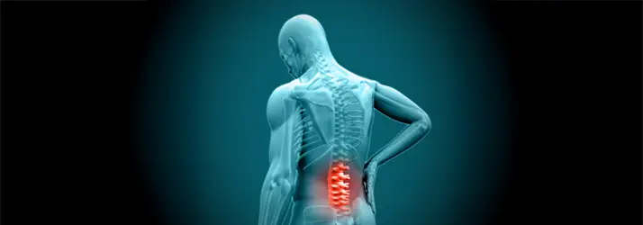 X-Ray 3D Illustration of a person with lower back highlighted indicating pain.